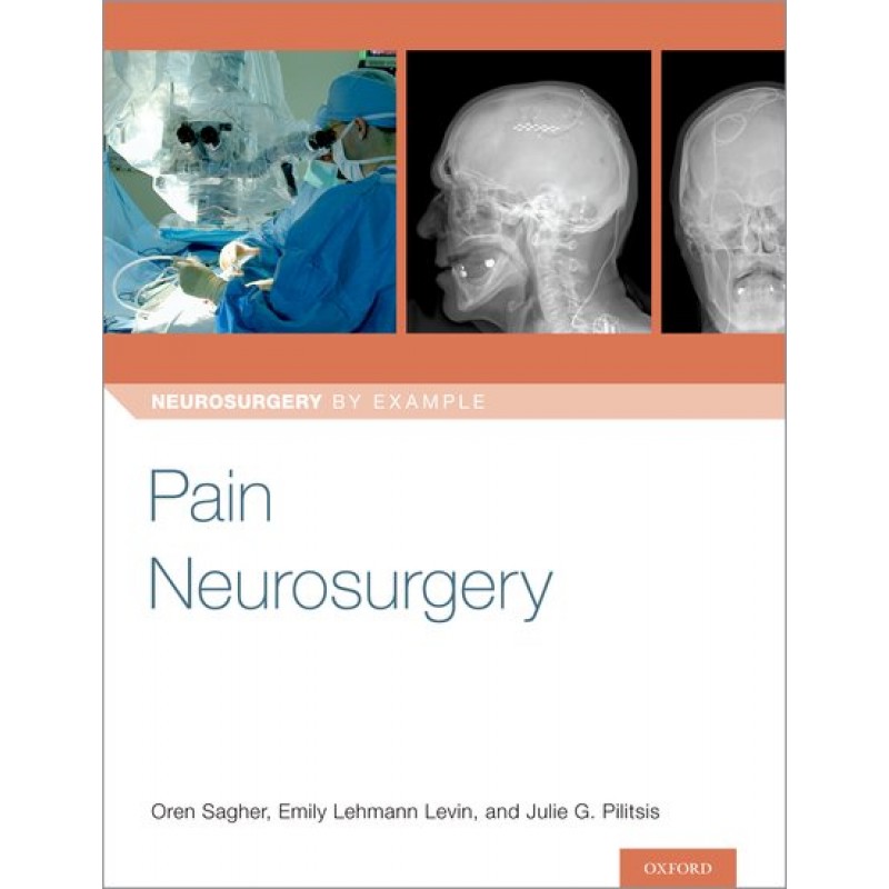 Pain Neurosurgery