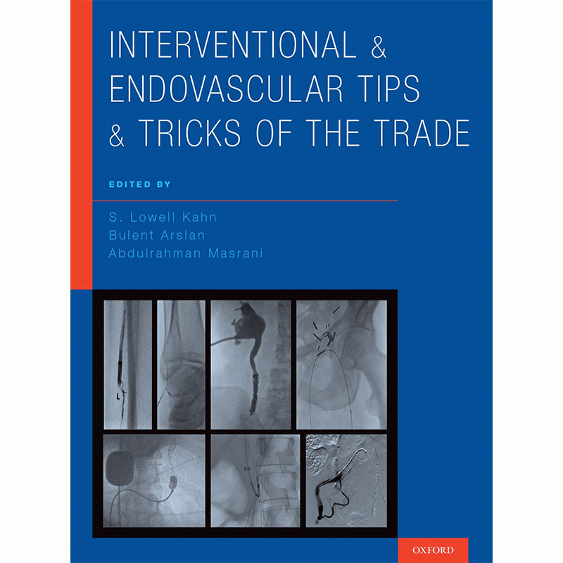 Interventional and Endovascular Tips and Tricks of the Trade