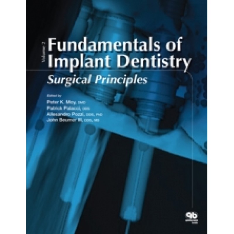 Fundamentals of Implant Dentristry, Volume II