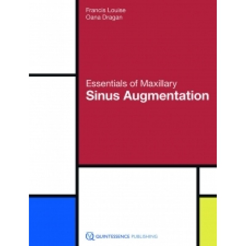 Essentials of Maxillary Sinus Augmentation