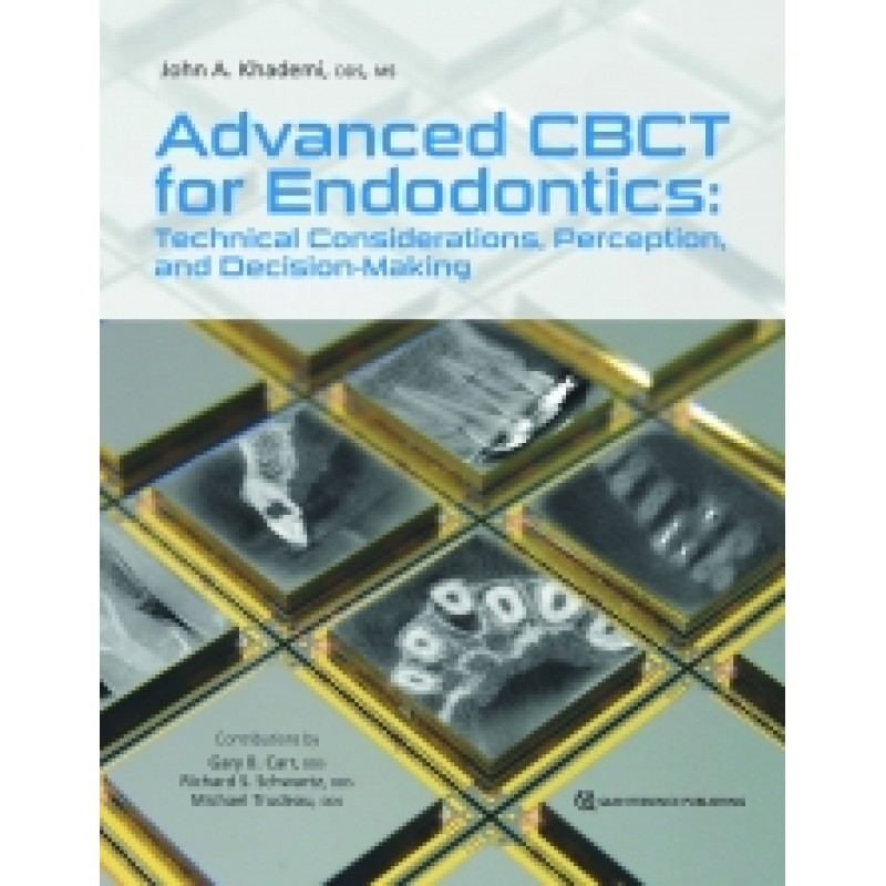 Advanced CBCT for Endodontics