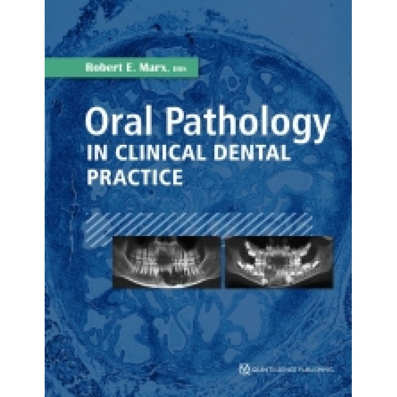 Oral Pathology in Clinical Dental Practice