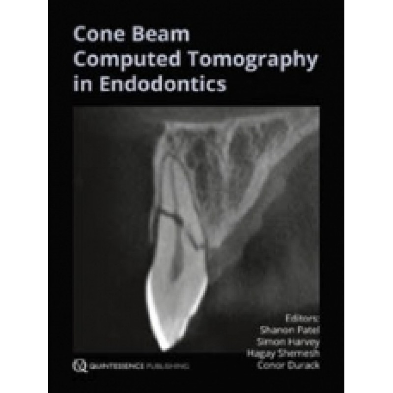 Cone Bean Computed Tomography in Endodontics