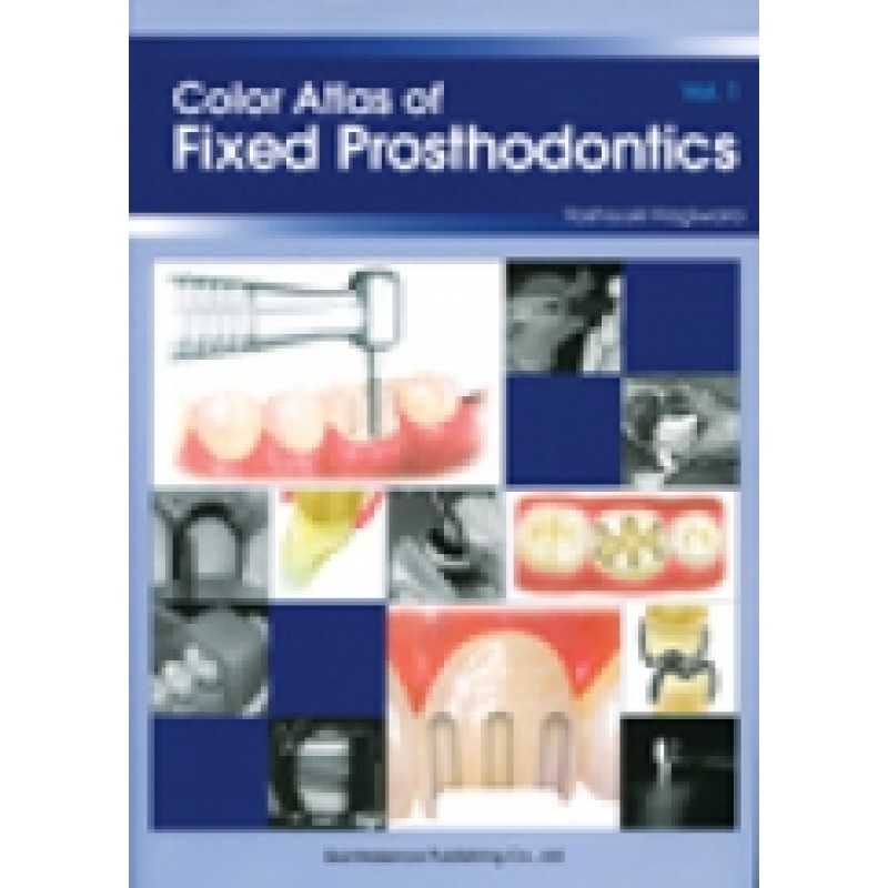 Color Atlas of Fixed Prosthodontics vol1