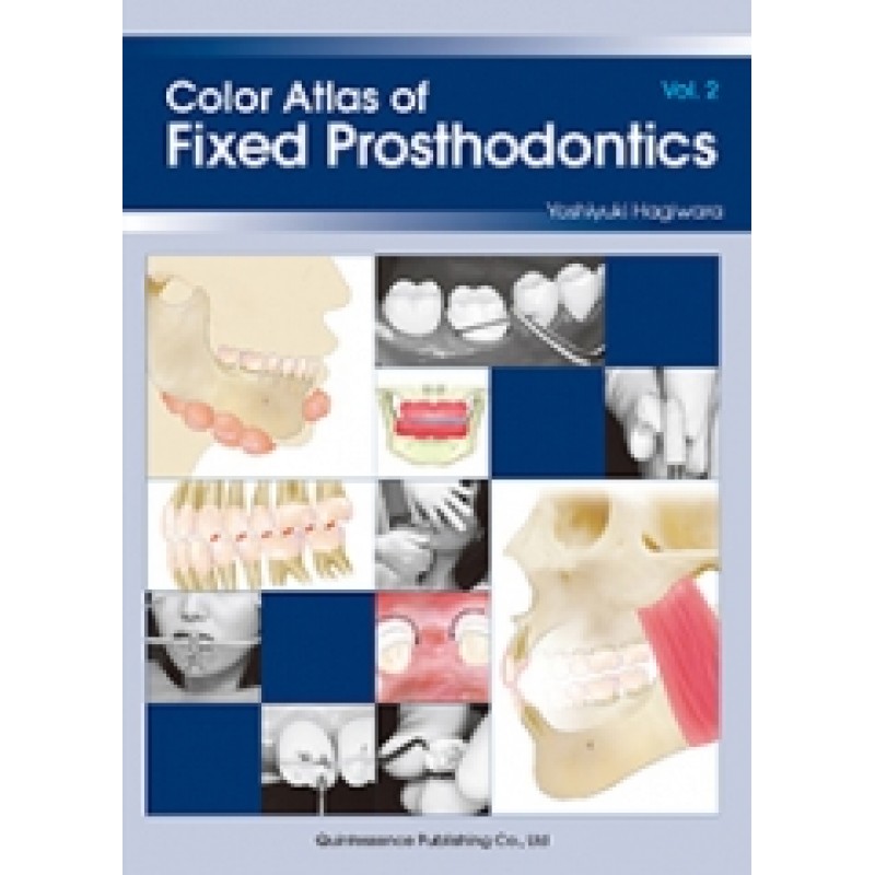 Color Atlas of Fixed Prosthodontics Vol2