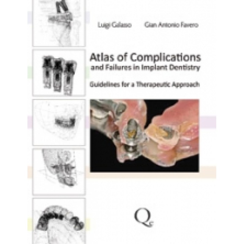 Atlas of Complications and Failures in Implantology