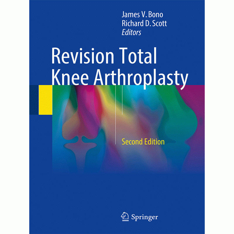 Revision Total Knee Arthroplasty by Bono and Scott, 2nd Edition