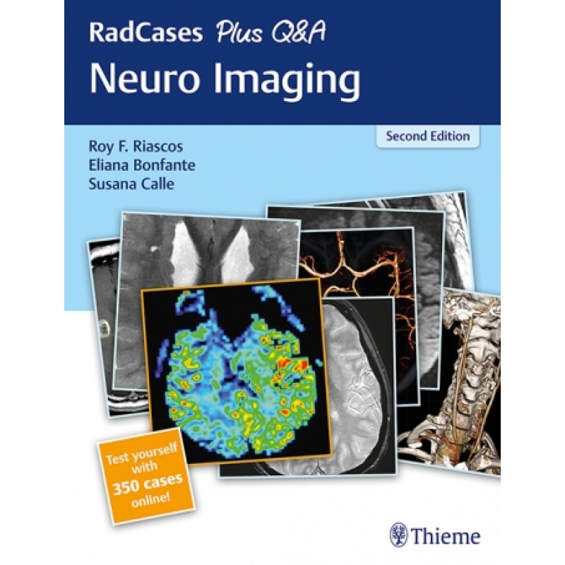 RadCases Plus Q-A Neuro Imaging