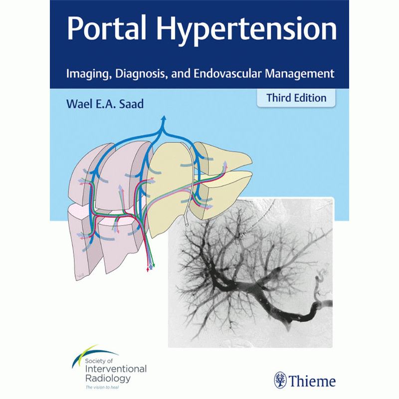 Portal Hypertension: Imaging, Diagnosis and Endovascular Management, 3rd Edition