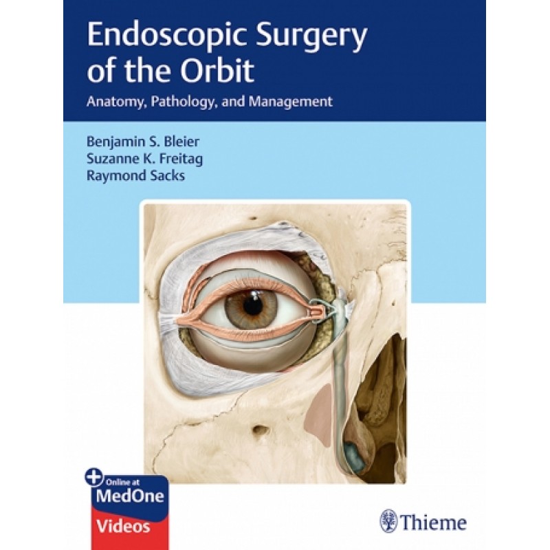 Endoscopic Surgery of the Orbit