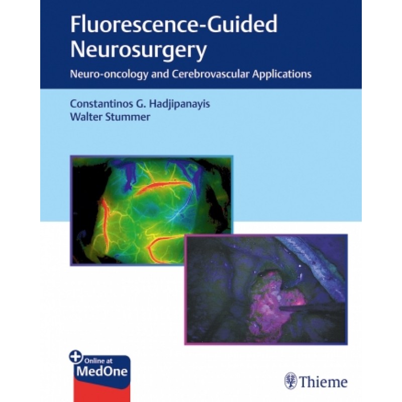 Fluorescence-Guided Neurosurgery