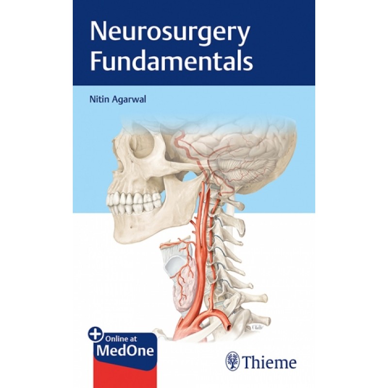 Neurosurgery Fundamentals