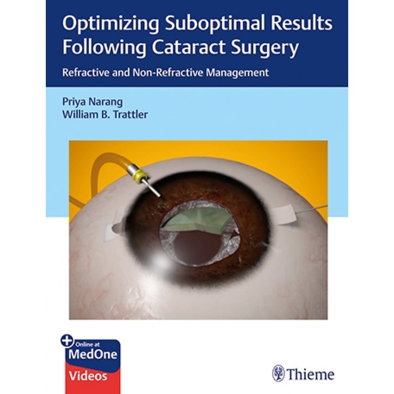 Optimizing Suboptimal Results Following Cataract Surgery