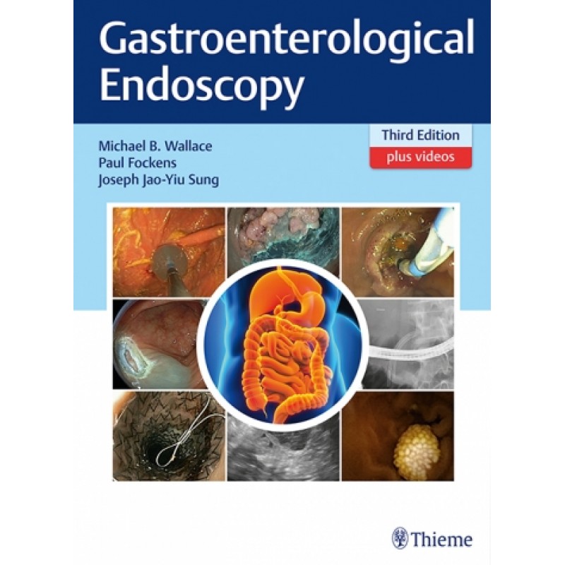 Gastroenterological Endoscopy