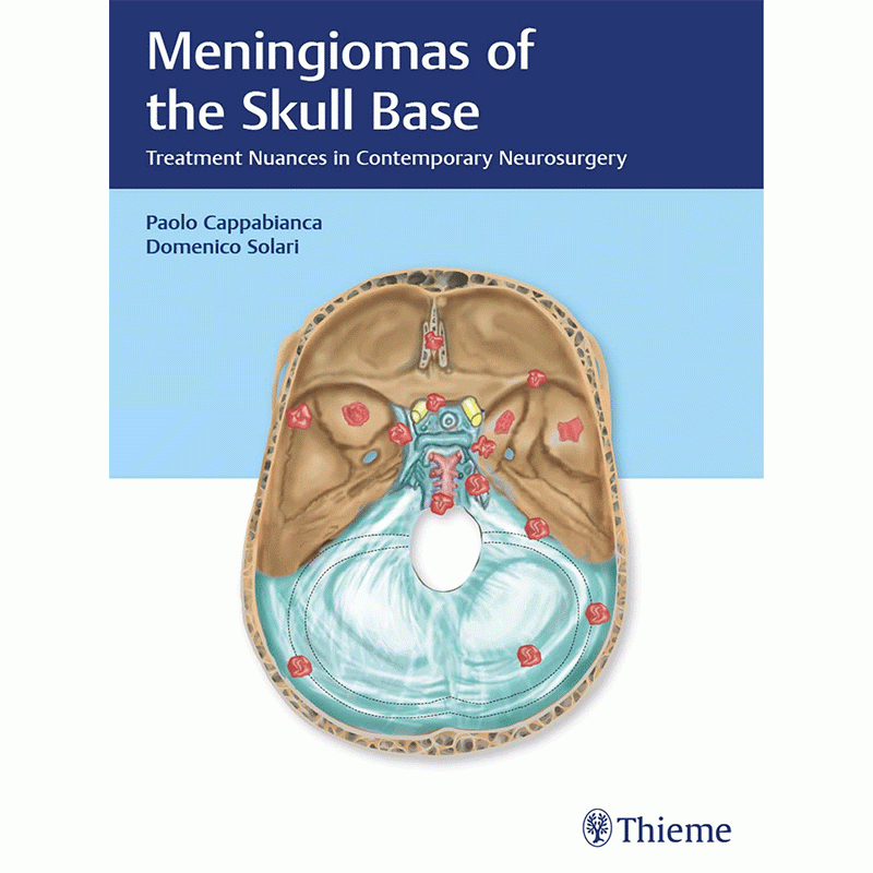 Meningiomas of the Skull Base: Treatment Nuances in Contemporary Neurosurgery