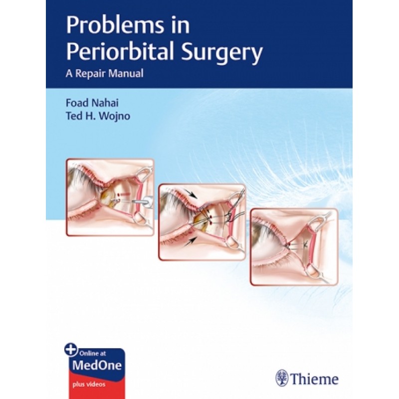 Problems in Periorbital Surgery