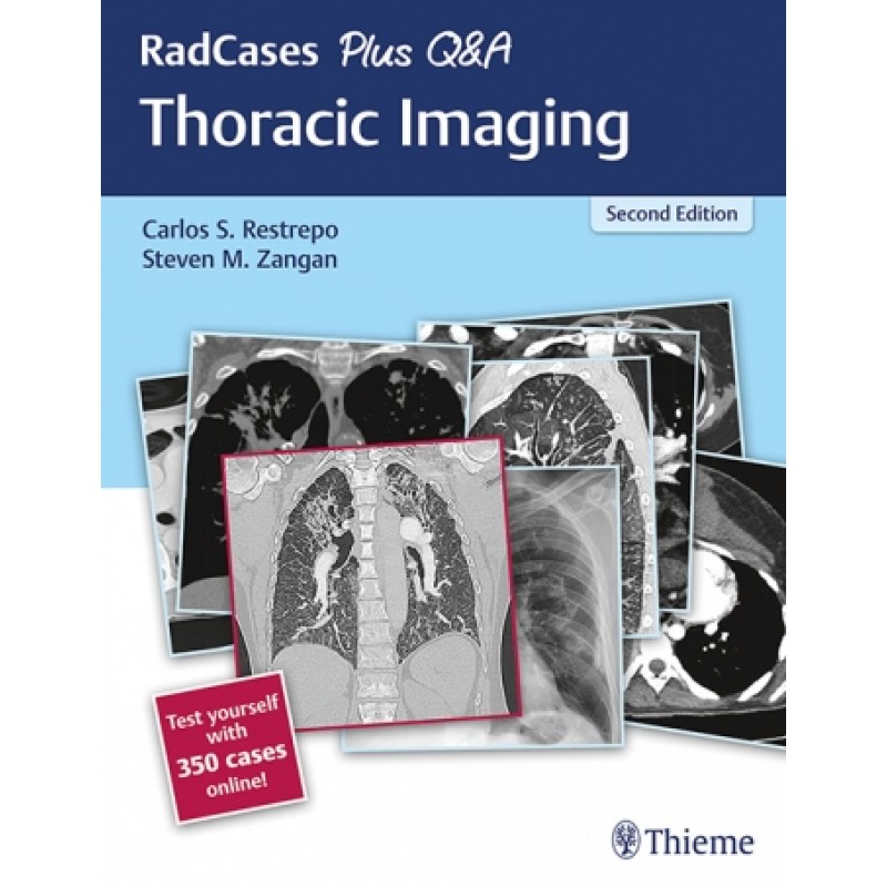 RadCases Plus Q-A Thoracic Imaging