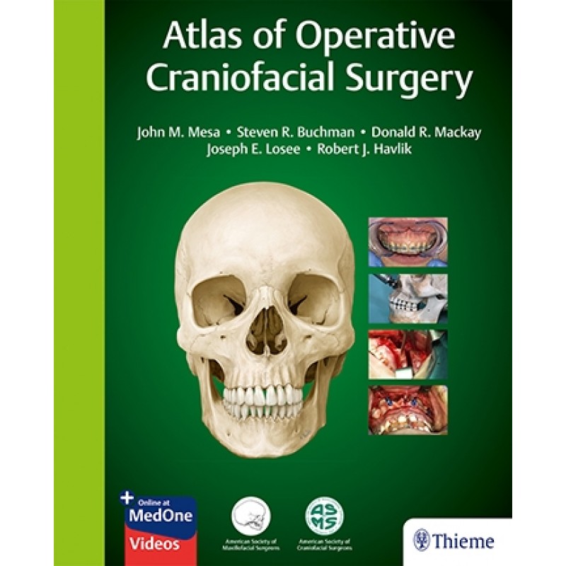 Atlas of Operative Craniofacial Surgery