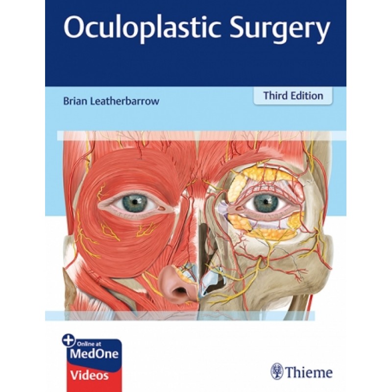 Oculoplastic Surgery, 3rd edition