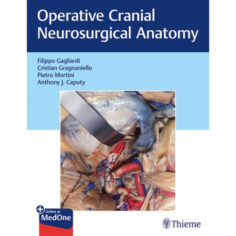 Operative Cranial Neurosurgical Anatomy