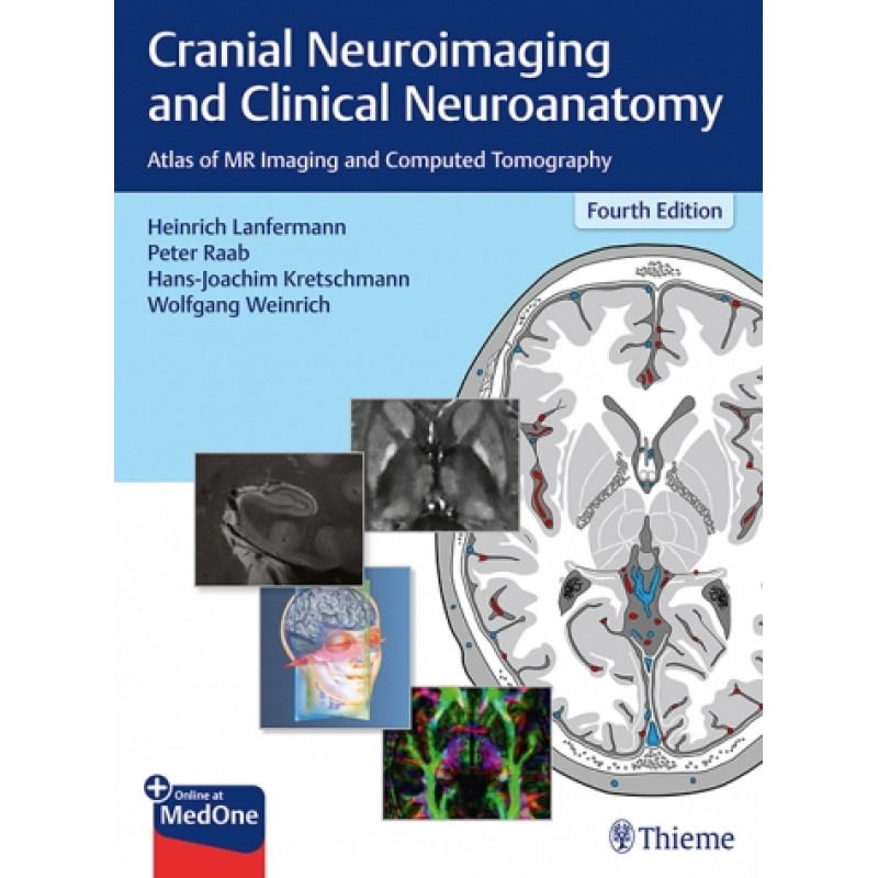 Cranial Neuroimaging and Clinical Neuroanatomy