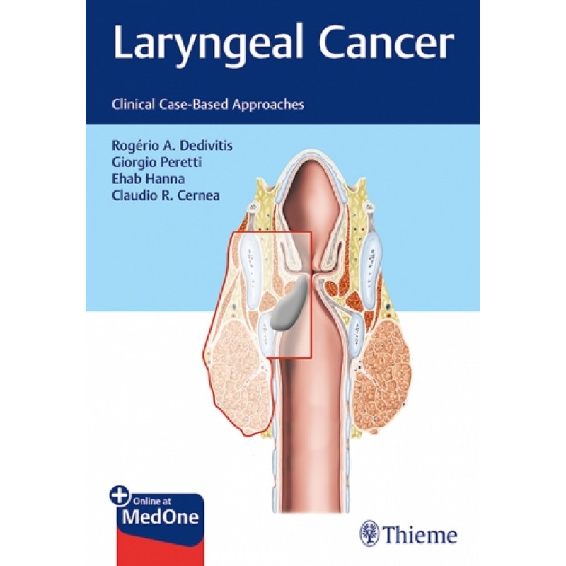 Laryngeal Cancer