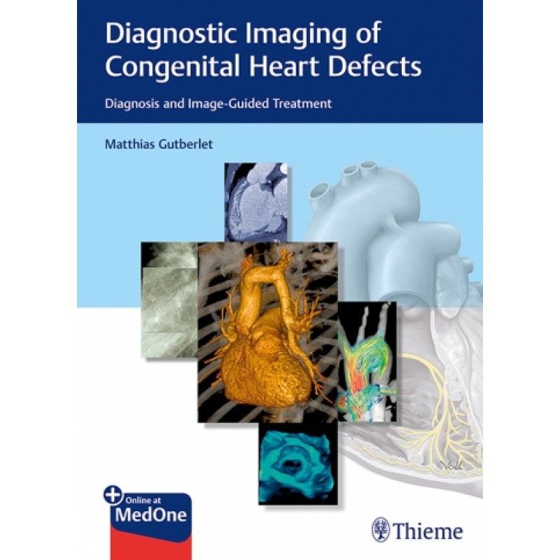 Diagnostic Imaging of Congenital Heart Defects