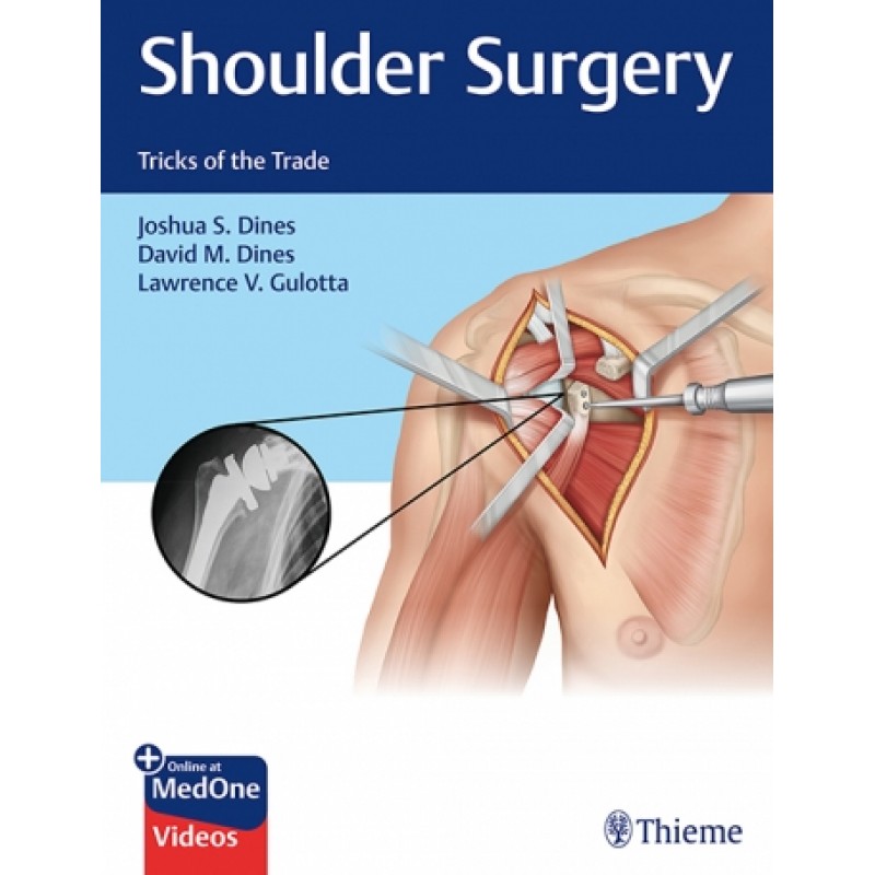 Shoulder Surgery