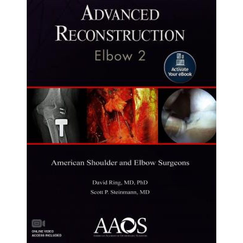 Advanced Reconstruction: Elbow 2, 2e-2018