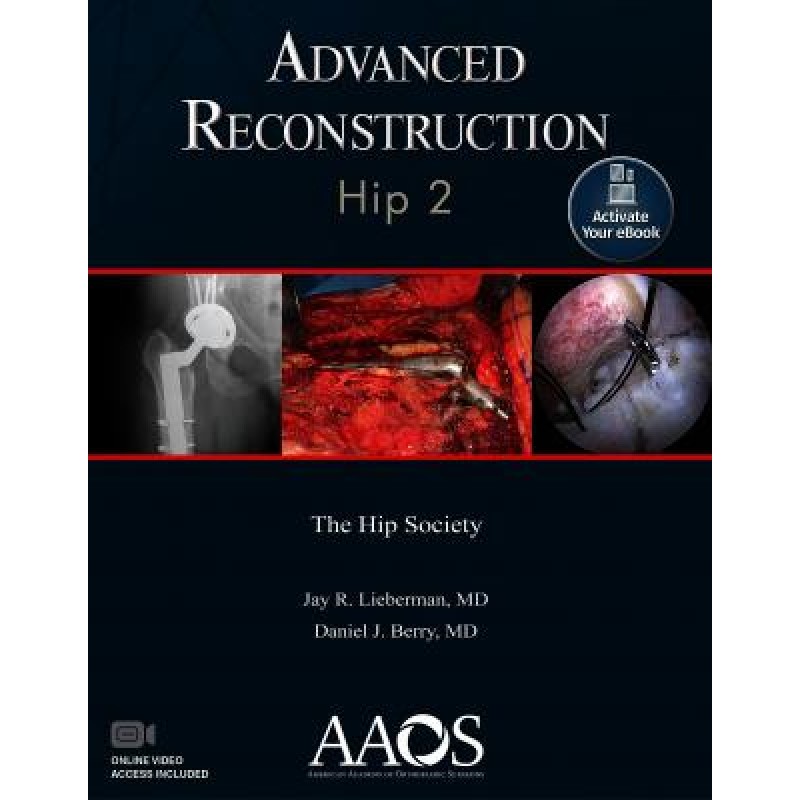 Advanced Reconstruction: Hip 2