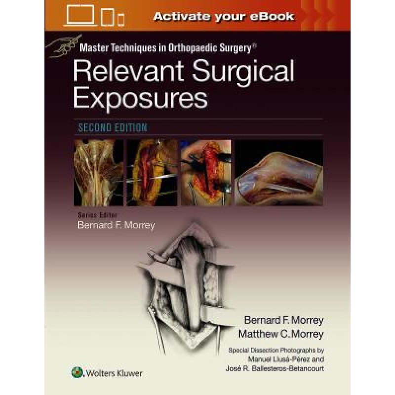 Master Techniques in Orthopaedic Surgery: Relevant Surgical Exposures, 2e