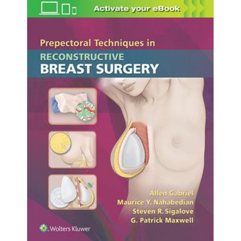 Prepectoral Techniques in Reconstructive Breast Surgery Prepectoral Techniques in Reconstructive Breast Surgery