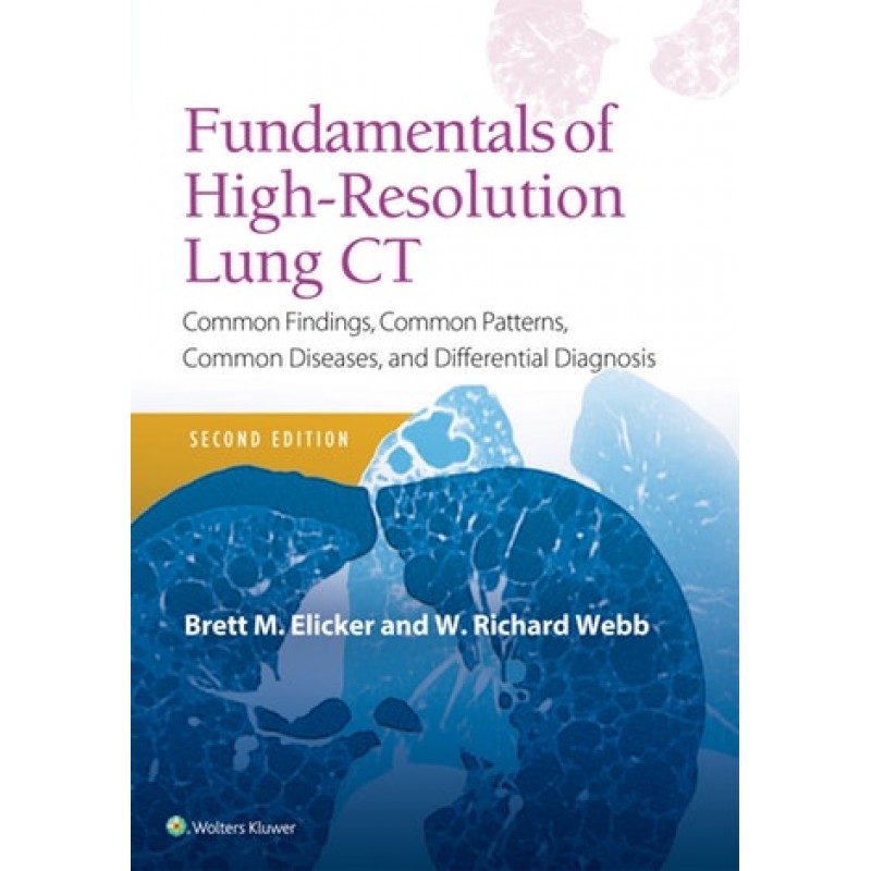 Fundamentals of High-Resolution Lung CT Common Findings, Common Patterns, Common Diseases and Differential Diagnosis, Second edition