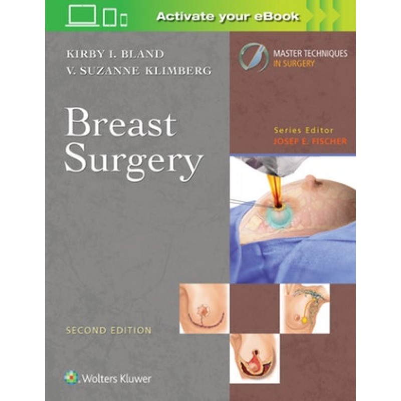 Master Techniques in Surgery: Breast Surgery Second edition