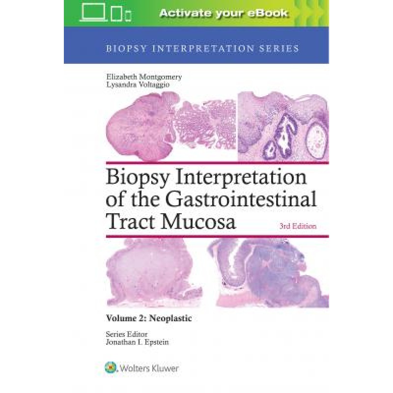 Biopsy Interpretation of the Gastrointestinal Tract Mucosa: Volume 2: Neoplastic, 3e