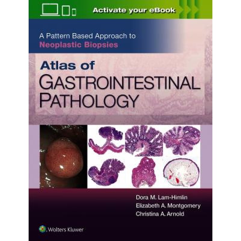 Atlas of Gastrointestinal Pathology: A Pattern Based Approach to Neoplastic Biopsies, 1e