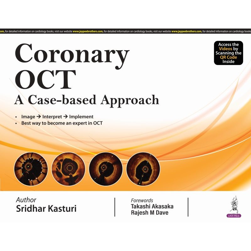 Coronary OCT: A case-based Approach