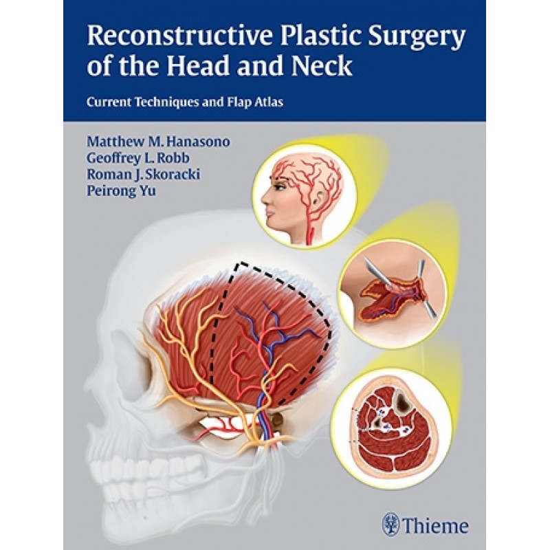  Reconstructive Plastic Surgery of the Head and Neck Current Techniques and Flap Atlas