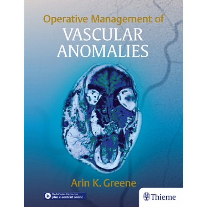 Operative Management of Vascular Anomalies