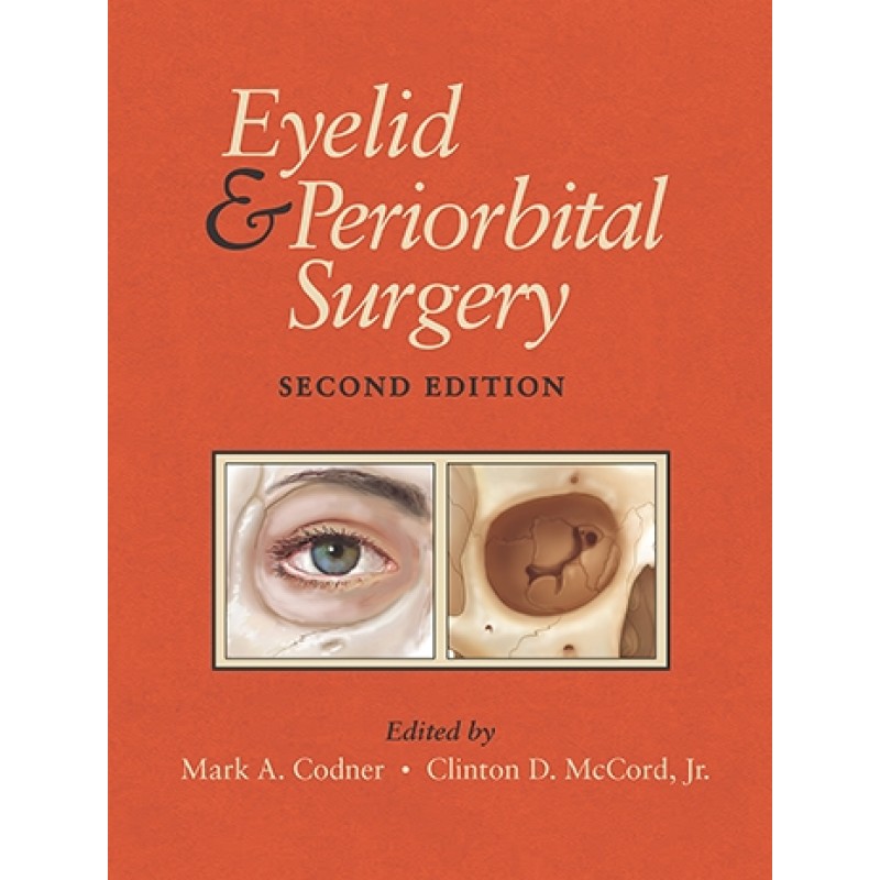 Eyelid and Periorbital Surgery 2nd Edition