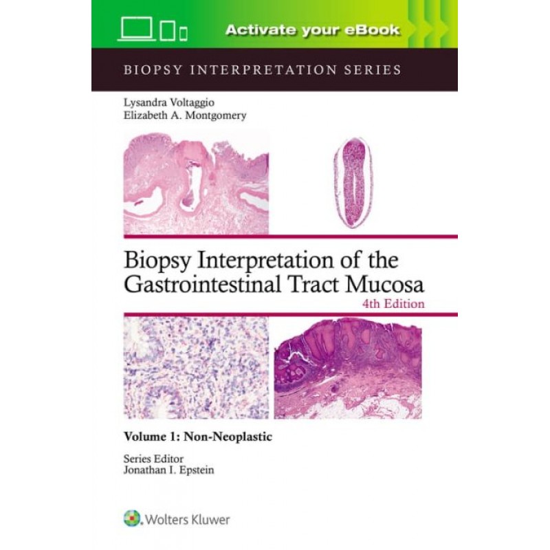 Biopsy Interpretation of the Gastrointestinal Tract Mucosa Volume 1. Non-Neoplastic: Print + eBook with Multimedia, Fourth edition