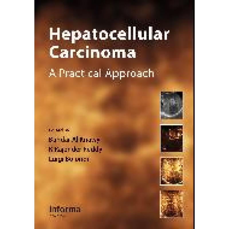 Hepatocellular Carcinoma: A Practical Approach