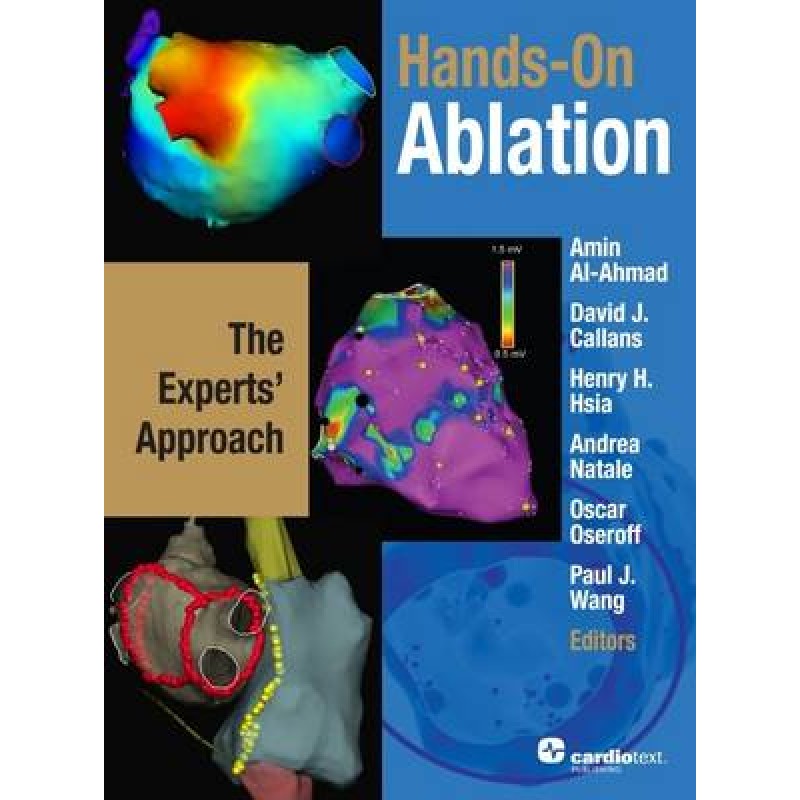 Hands-On Ablation: The Experts' Approach