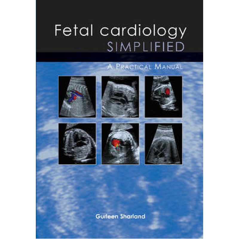 Fetal Cardiology Simplified: A Practical Manual