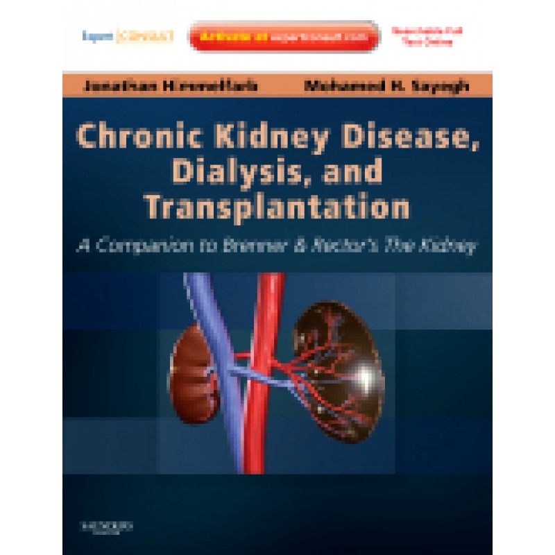 Chronic Kidney Disease, Dialysis, and Transplantation, 3rd Edition