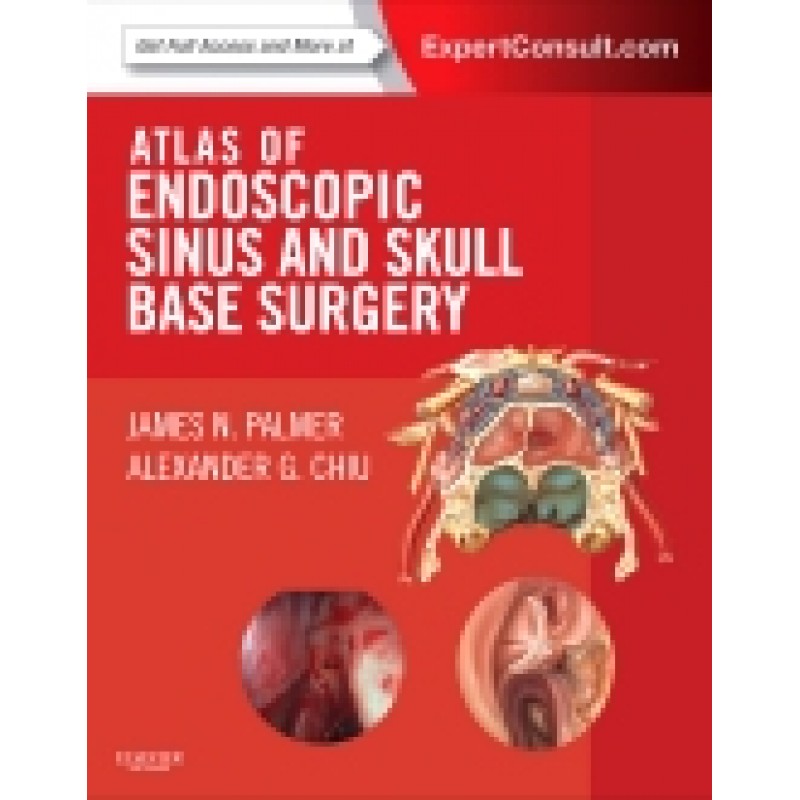 Atlas of Endoscopic Sinus and Skull Base Surgery