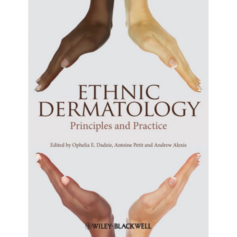 Ethnic Dermatology: Principles and Practice