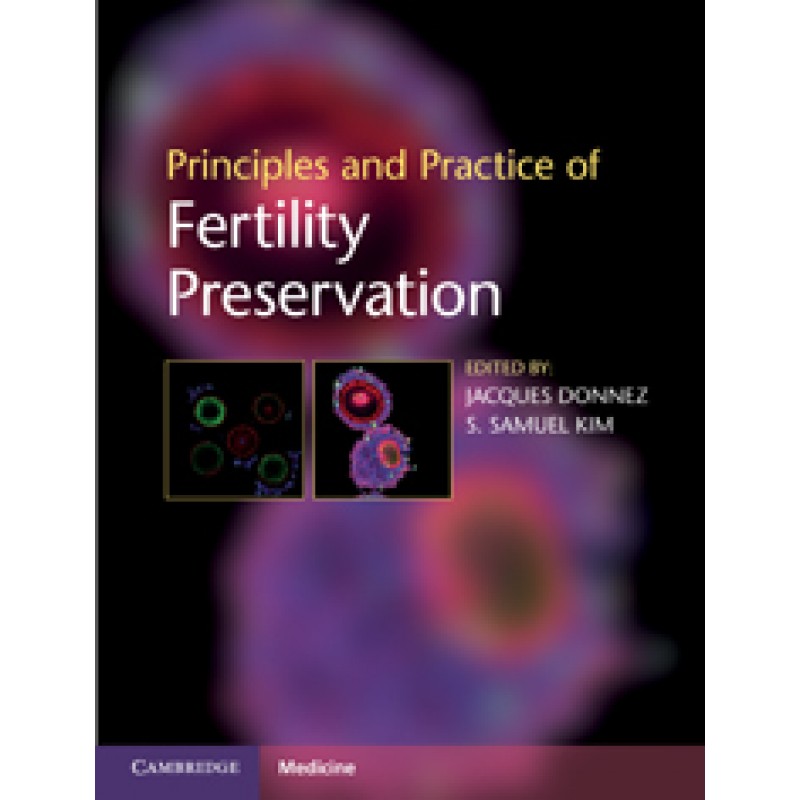 Principles and Practice of Fertility Preservation