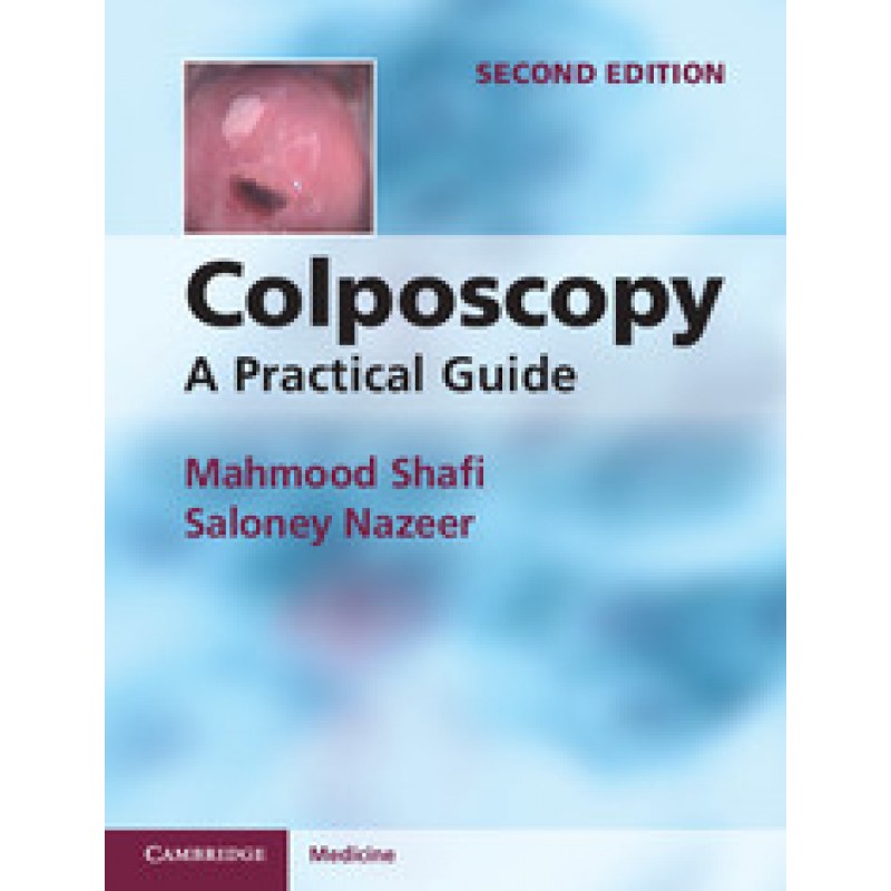 Colposcopy, 2nd Edition