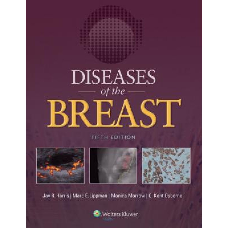 Diseases of the Breast 5e